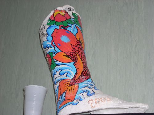 病院の診察室に飾られてあった使用済入れ墨風ギブス