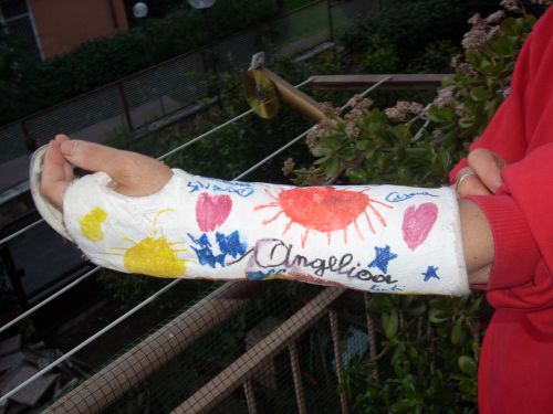 私の腕のギブスに子供のイラストが描かれている