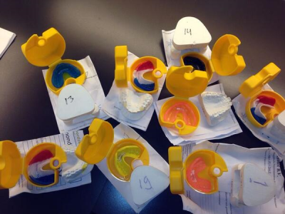 まず歯型を取って・・・(画像提供：Ad.nl)