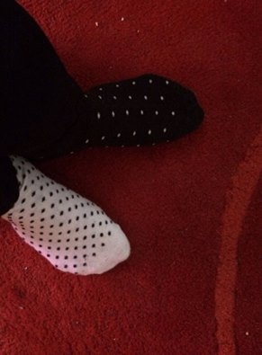 何故、左右違うの？と思ってしまいましたが…