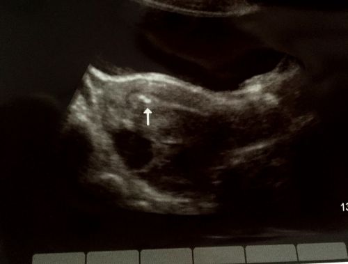 矢印は体内の受精卵を示しています。11月17日撮影