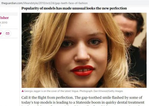 すきっ歯が人気になっていることを報じた、Guardian紙のウェブサイト